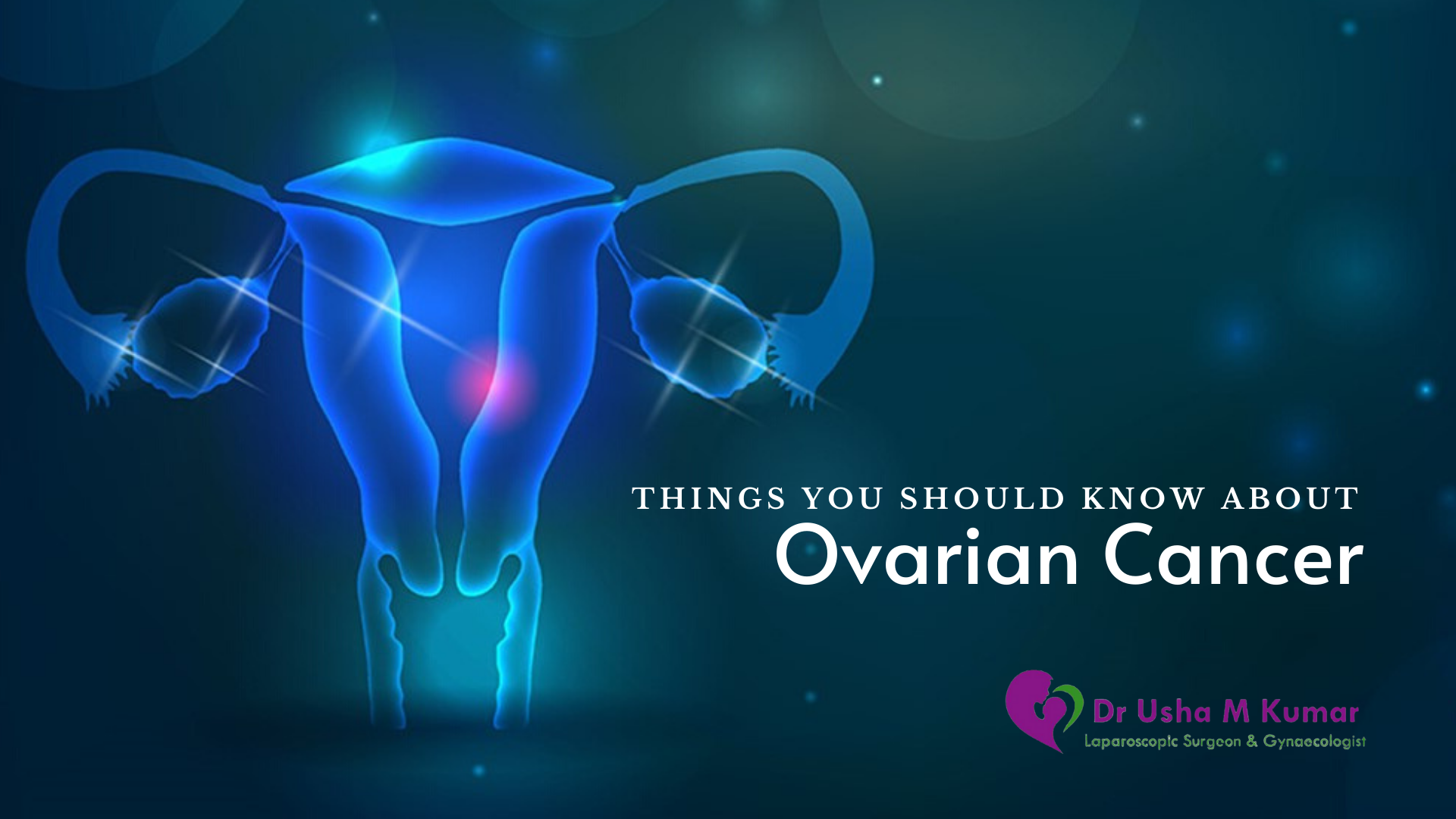 Things you should know about Ovarian Cance