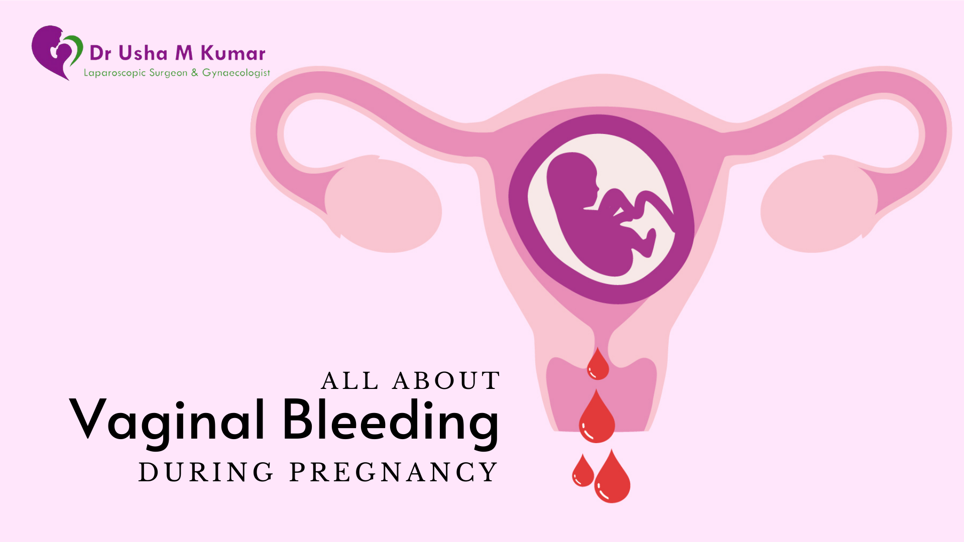 Vaginal Bleeding during Pregnancy