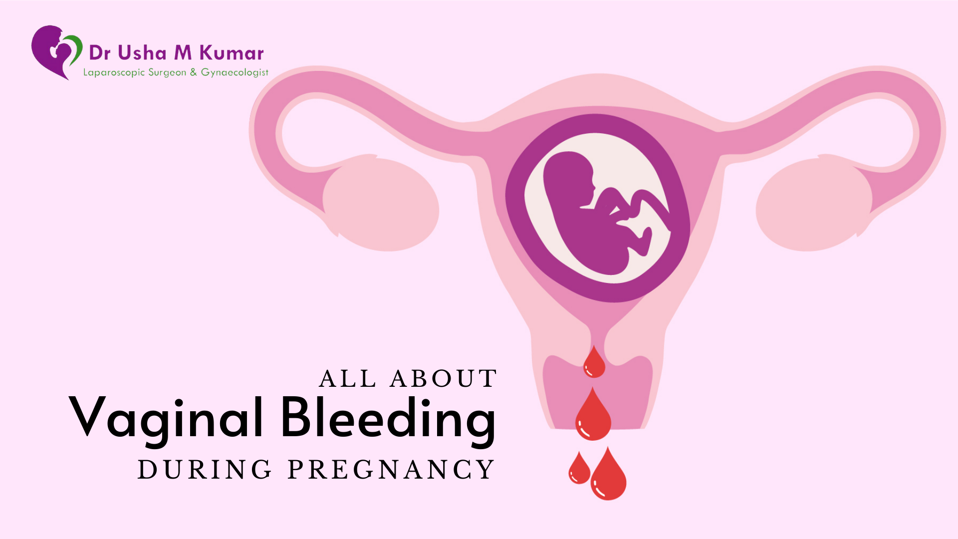 Best Gynecologist In Delhi Vaginal Bleeding During Pregnancy