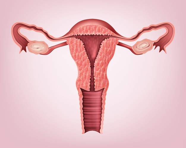 uterine fibroids