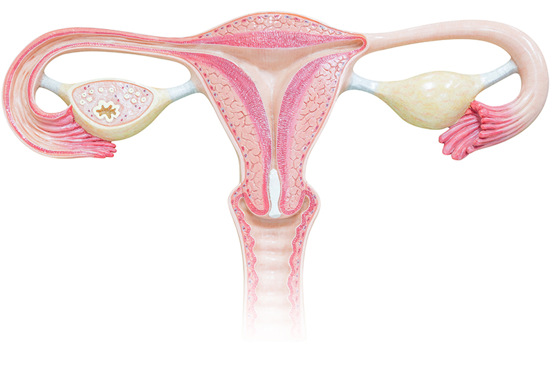 Gynecologic Cancer