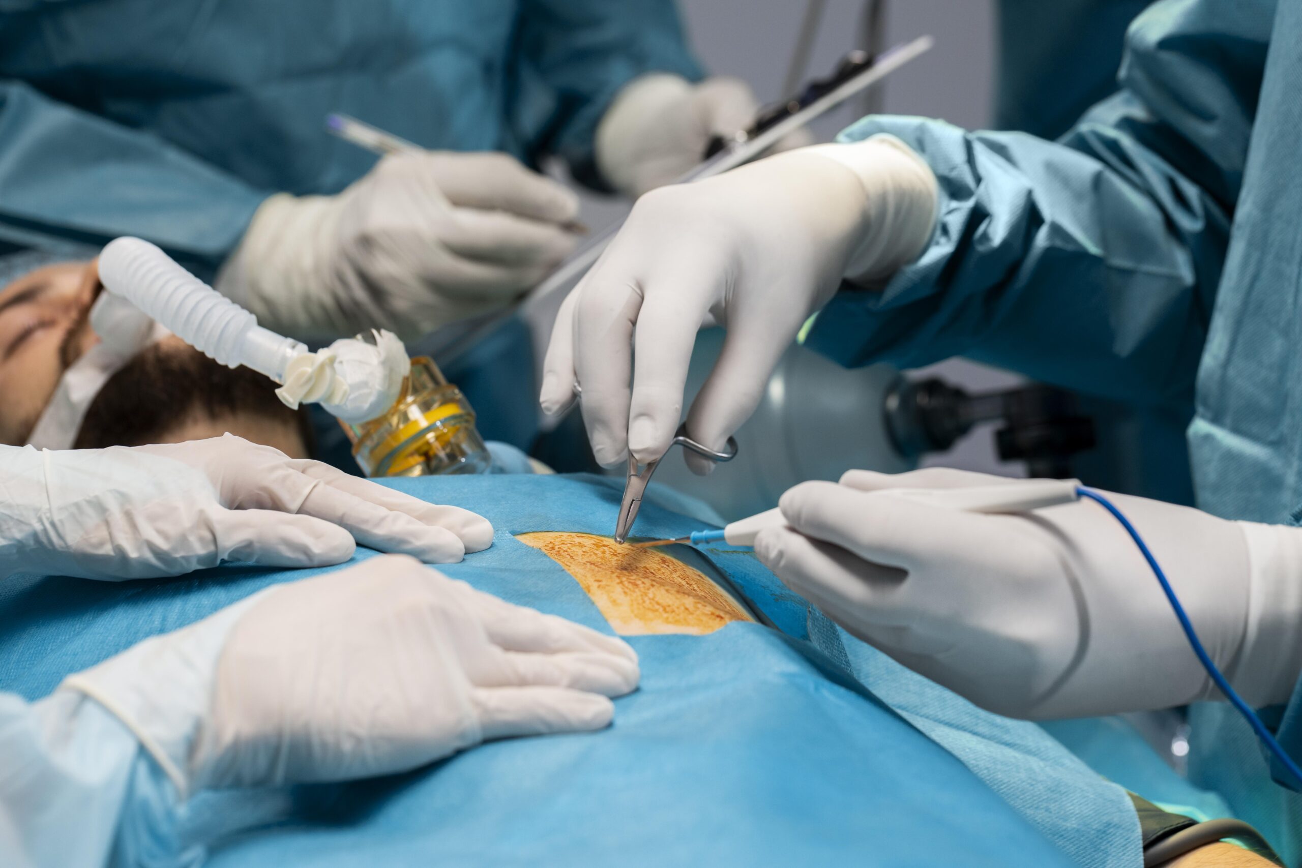 Benefits Of Laparoscopic Surgery - Dr Usha M Kumar