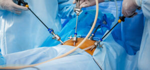 Laparoscopic Gynecological Surgery - Dr. Usha M Kumar