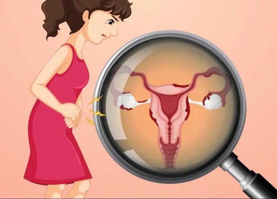 Robotic Surgery for Ovarian Cysts - Dr. Usha M Kumar