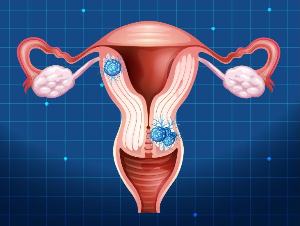 Women’s Annual Health Check-ups with a Gynecologist in Delhi